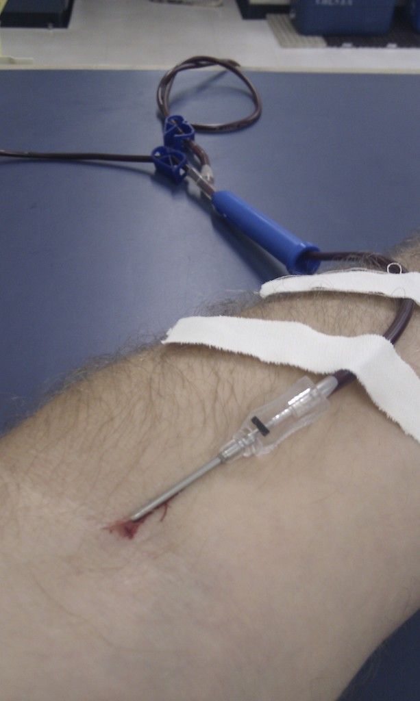 The Critical Organ in High Demand in Germany